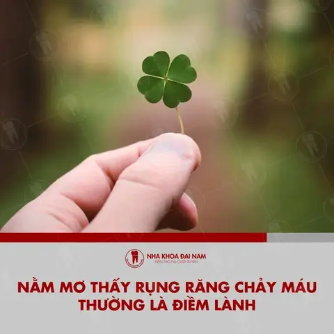 Nằm Mơ Thấy Rụng Răng Chảy Máu Là Điềm Gì?