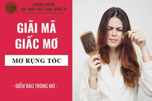 Nằm Mơ Thấy Rụng Tóc Hói Đầu Báo Hiệu Điềm Gì?