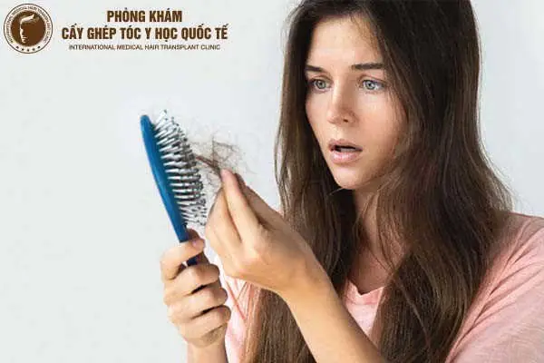 Nằm Mơ Thấy Rụng Tóc Nhiều