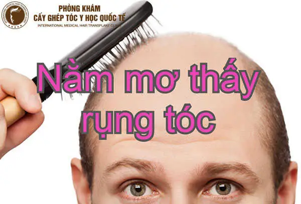 Với Nam Giới Giấc Mơ Rụng Tóc Có Ý Nghĩa Gì?