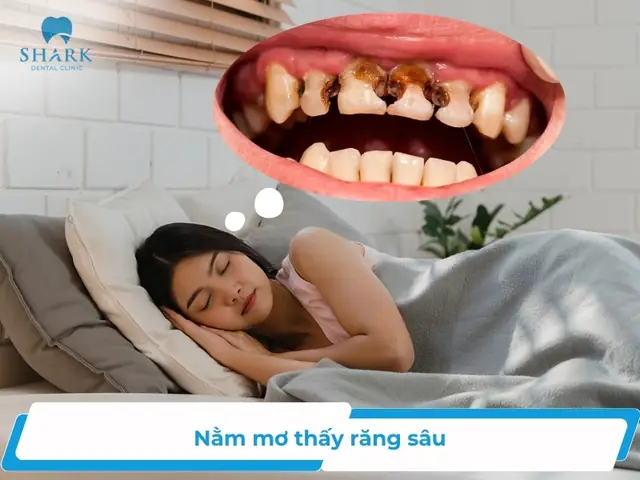 Nằm Mơ Thấy Răng Sâu Là Điềm Gì? Nên Đánh Con Số Nào?