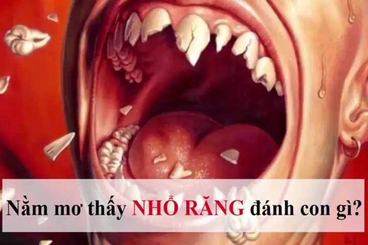 Nằm Mơ Thấy Tự Nhổ Răng Không Chảy Máu