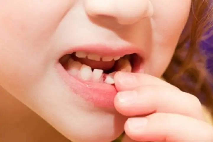 Giải Mã Giấc Mơ Tự Nhổ Răng Nhưng Không Chảy Máu