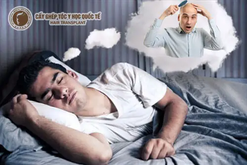 Mơ Thấy Hói Đầu Báo Hiệu Điềm Gì? - Cấy Ghép Tóc Tóc Y Học Quốc ...