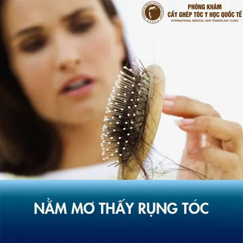 Nằm Mơ Thấy Rụng Tóc Hói Đầu Có Điềm Báo Gì? | Blog