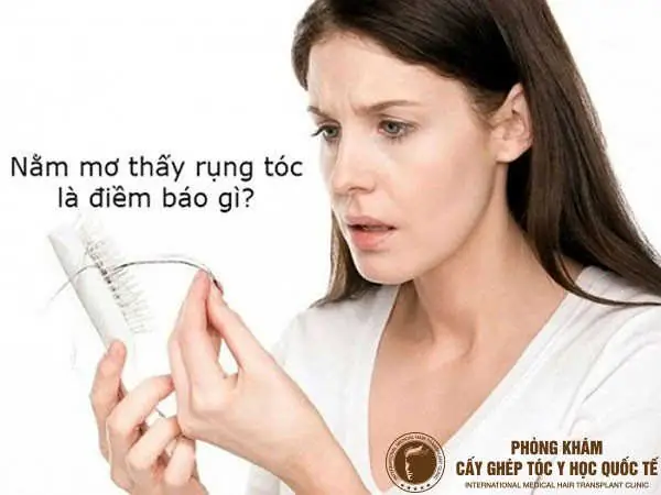 Nằm Mơ Thấy Rụng Tóc Hói Đầu Là Điềm Tốt Hay Xấu?