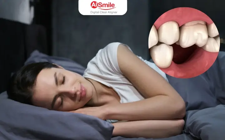 Mơ Rụng Răng: Giải Mã Điềm Báo & Sự Thật Từ Chuyên Gia | Ai ...