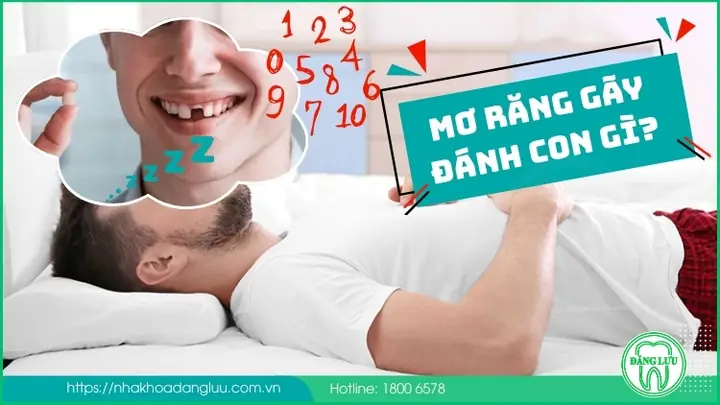 Mơ Răng Gãy Đánh Con Gì? Điềm Báo Ra Sao?