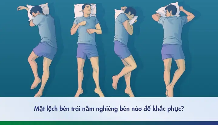 Mặt Lệch Bên Trái Phải Nằm Nghiêng Bên Nào Để Khắc Phục?