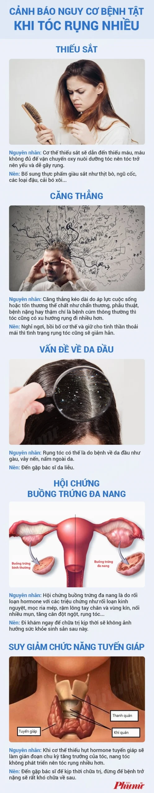 Rụng tóc là bệnh gì? Nguyên nhân và cách điều trị hiệu quả Hình ảnh minh họa các phương pháp điều trị rụng tóc